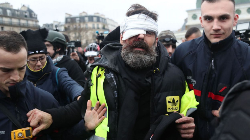 Gilets jaunes à Paris: Jérôme Rodrigues, un des organisateurs, touché à l'œil